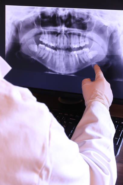 Best Emergency Dental Extractions in Canaan, CT
