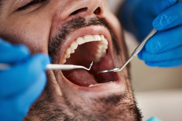 Best Emergency Dentist for Knocked-Out Tooth in Canaan, CT