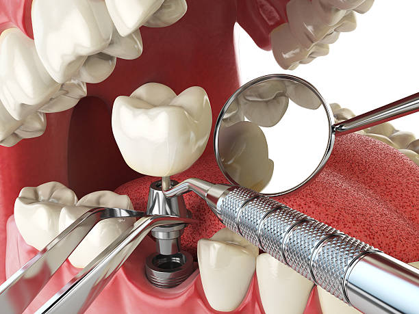 Best Orthodontic Emergency Dentist in Canaan, CT